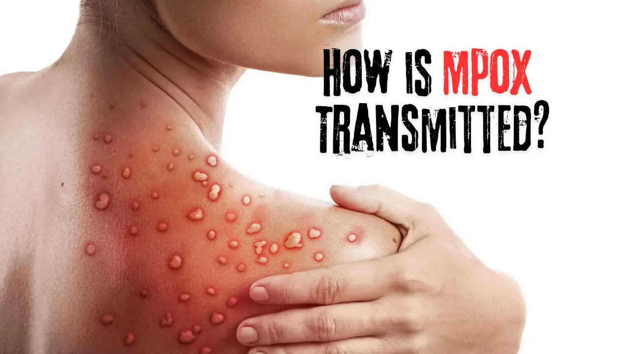 How is Mpox Transmitted?
